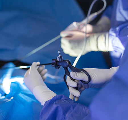 The Vital Role of Hysteroscopy in IVF: A Comprehensive Guide